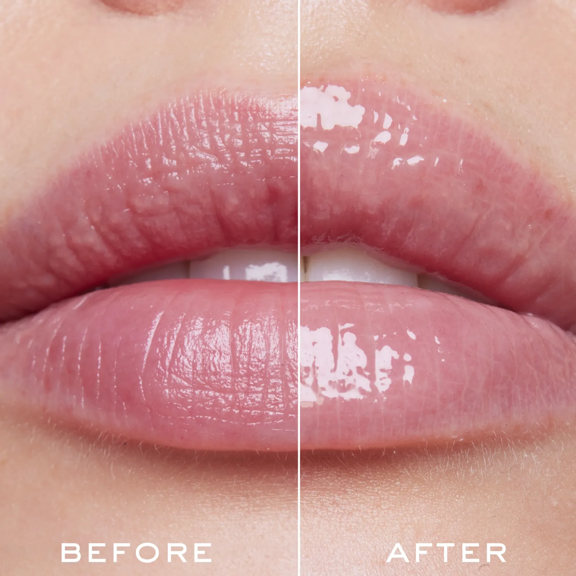 Discount Aufpolsterndes lippenserum Zum Kleinen Preis|Lippenpflege
