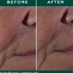 Flash Sale Die Globale Anti-Aging-Creme Tagescreme|Anti-Aging