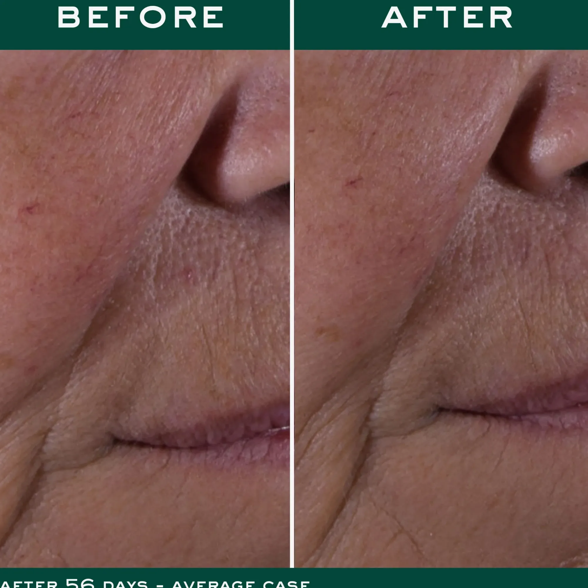 Flash Sale Die Globale Anti-Aging-Creme Tagescreme|Anti-Aging